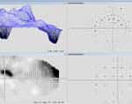Glaucoma Test Combinaision View