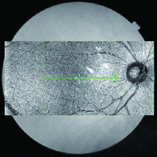 OCT500 Advanced Robotic OCT - Essilor Instruments USA