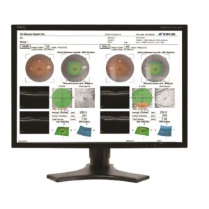 OCT500 Advanced Robotic OCT - Essilor Instruments USA