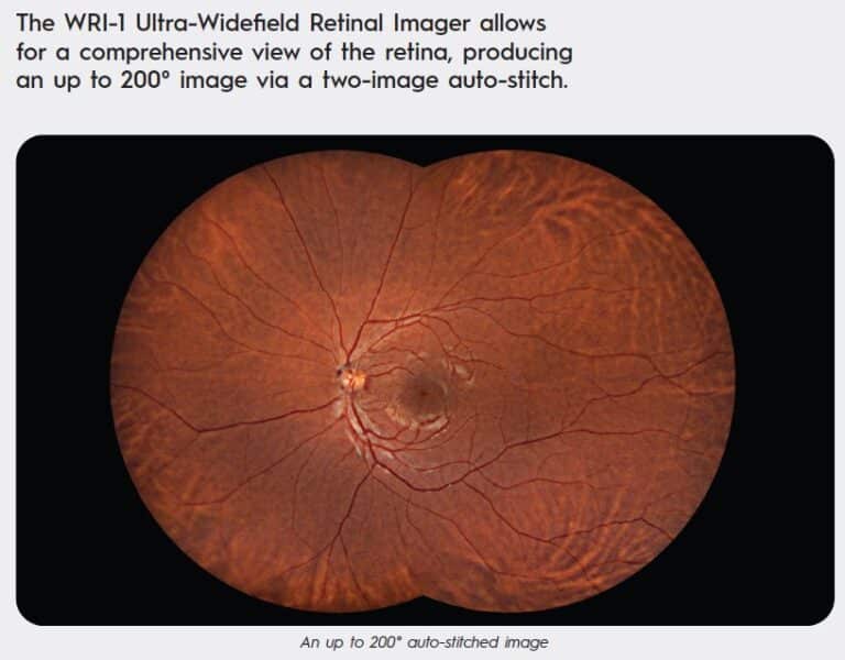 Cellview Imaging - WRI-1 Retinal Imager - Essilor Instruments USA