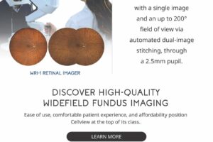 New Product Introduction - Cellview Retinal Camera
